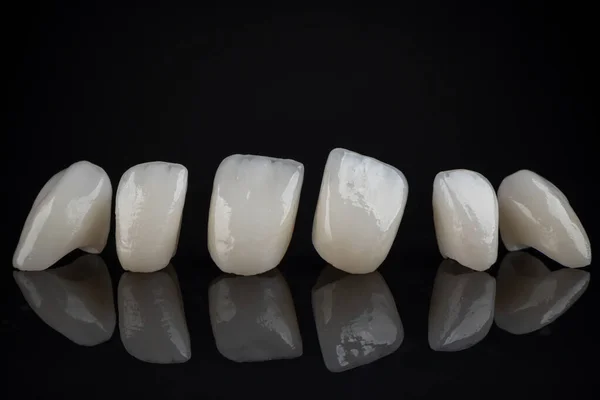 How Long Dental Crowns Last (And What Affects Their Lifespan)