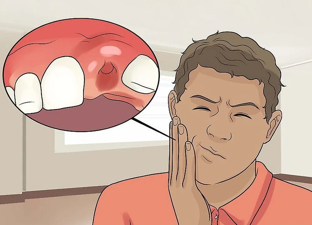 What to Avoid After a Tooth Extraction